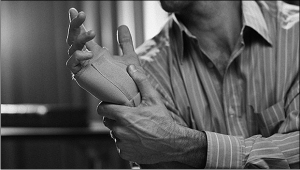 carpal tunnel